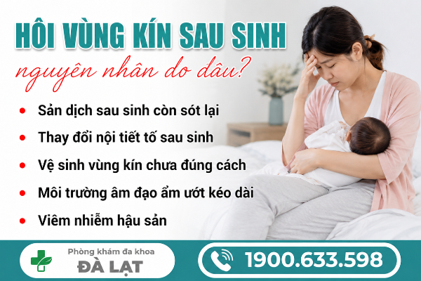 Hình ảnh minh họa